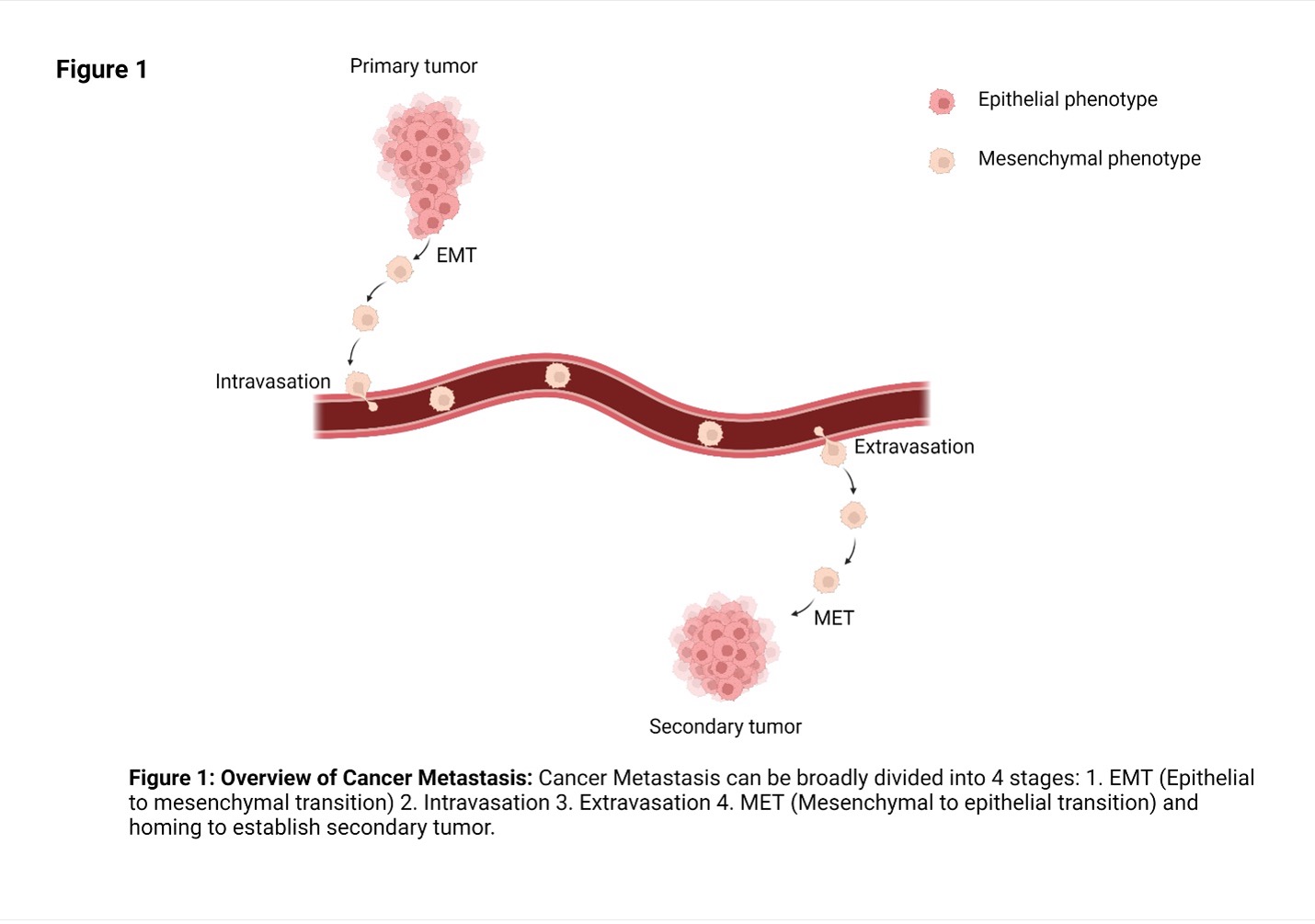 metastasis