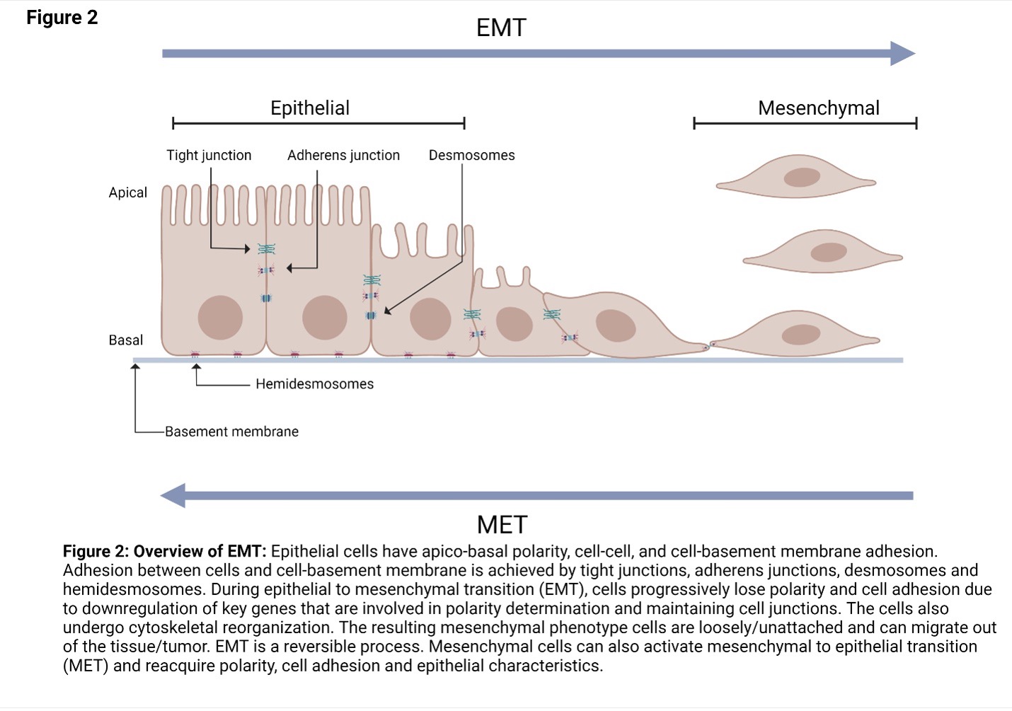 epithelial mesenchymal transition cancer